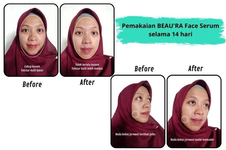 Hasil perawatan wajah dengan serum BEAU'RA
